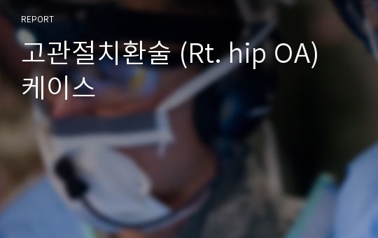 고관절치환술 (Rt. hip OA) 케이스