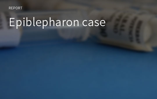 Epiblepharon case