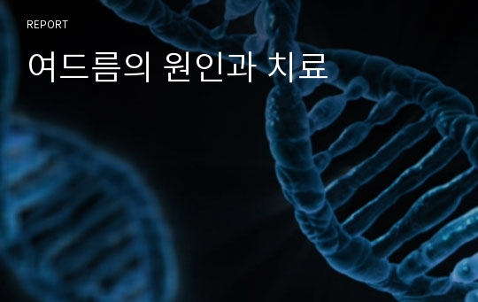 여드름의 원인과 치료