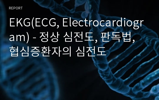 EKG(ECG, Electrocardiogram) - 정상 심전도, 판독법, 협심증환자의 심전도