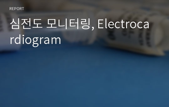 심전도 모니터링, Electrocardiogram