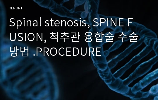 Spinal stenosis, SPINE FUSION, 척추관 융합술 수술방법 .PROCEDURE