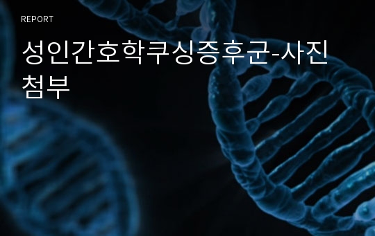 성인간호학쿠싱증후군-사진첨부