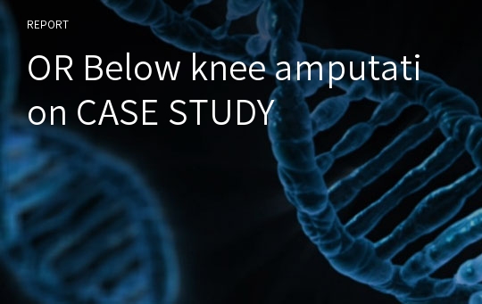 OR Below knee amputation CASE STUDY