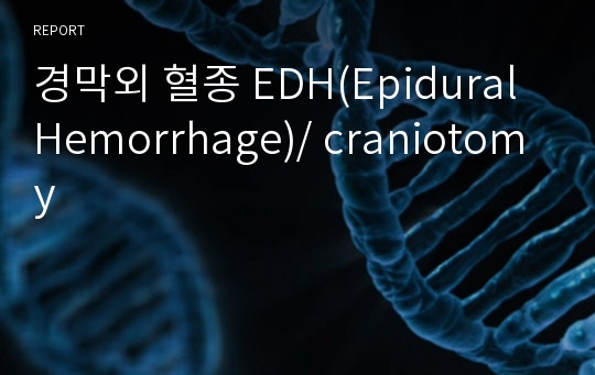 경막외 혈종 EDH(Epidural Hemorrhage)/ craniotomy