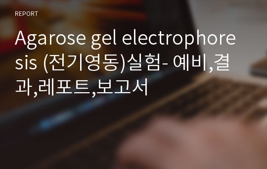 Agarose gel electrophoresis (전기영동)실험- 예비,결과,레포트,보고서