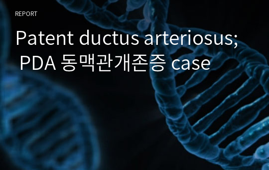 Patent ductus arteriosus; PDA 동맥관개존증 case