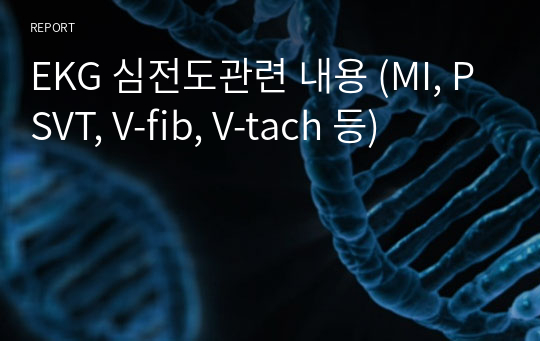 EKG 심전도관련 내용 (MI, PSVT, V-fib, V-tach 등)