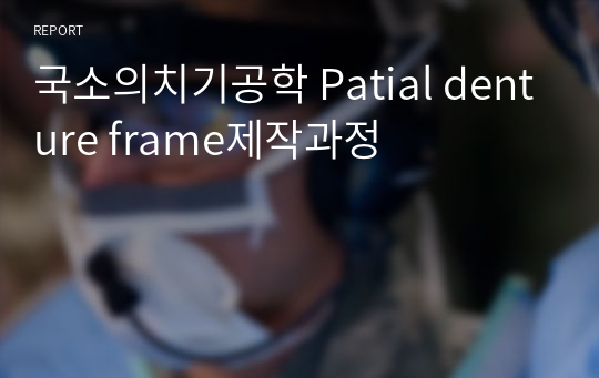 국소의치기공학 Patial denture frame제작과정