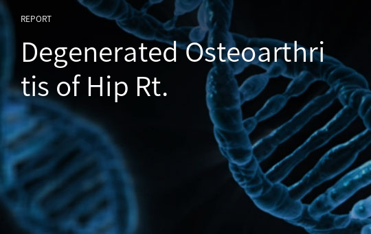 Degenerated Osteoarthritis of Hip Rt.