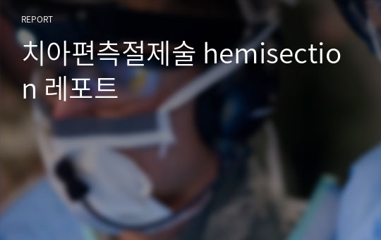 치아편측절제술 hemisection 레포트