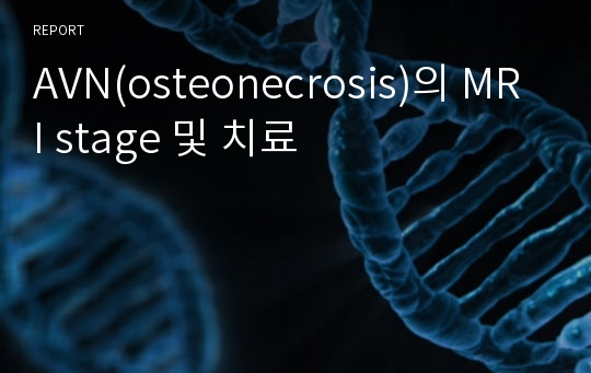 AVN(osteonecrosis)의 MRI stage 및 치료