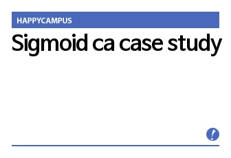 Sigmoid ca case study