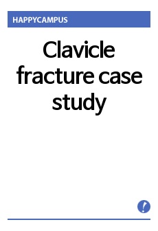 Clavicle fracture case study, 쇄골골절 환자 간호과정 레포트