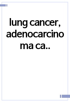 lung cancer, adenocarcinoma case study