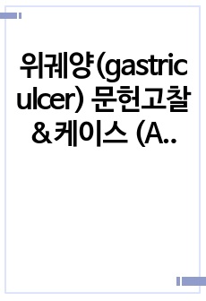 위궤양(gastric ulcer) 문헌고찰&케이스 (A+)