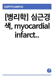 [병리학] 심근경색, myocardial infarction(MI) 문헌고찰 레포트(뼈를 갈아서 만듬, 교수님 극찬)