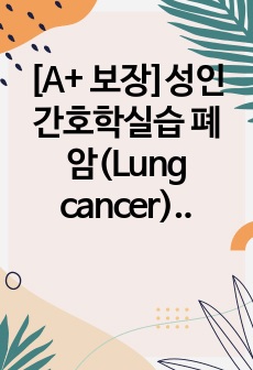 [A+ 보장]성인간호학실습 폐암(Lung cancer) 간호, 간호과정, 간호진단, 컨퍼런스, 케이스스터디 30페이지 자료입니다.